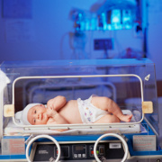 Jaundice in Newborns